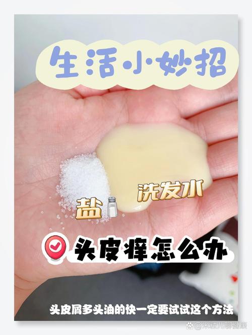 详细阅读:头皮瘙痒,头发护理的关键“战役” 头皮瘙痒,头发护理的关键“战役”