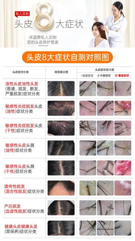 头发护理中头皮瘙痒的原因探秘