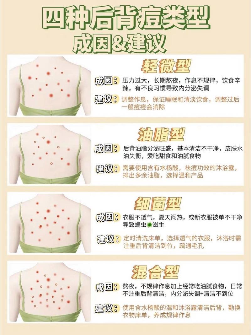 告别背部痘痘：全面攻略与日常护理要点