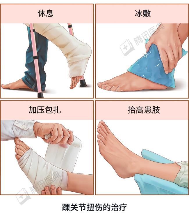 详细阅读:关节扭伤的处理:全面指南 关节扭伤的处理:全面指南