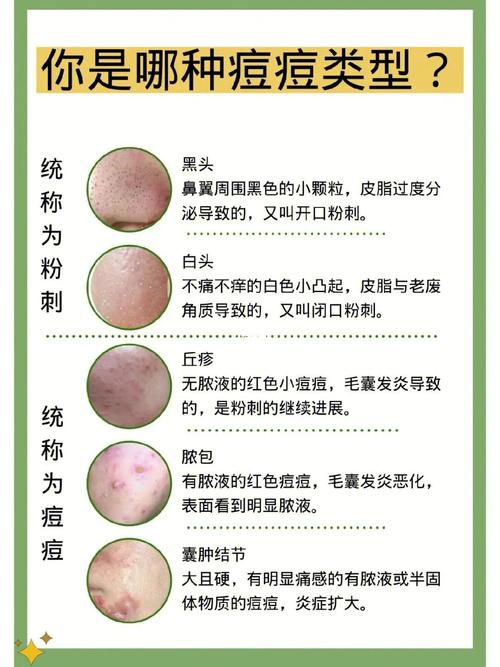 白头处理方式：全面解析与应对策略