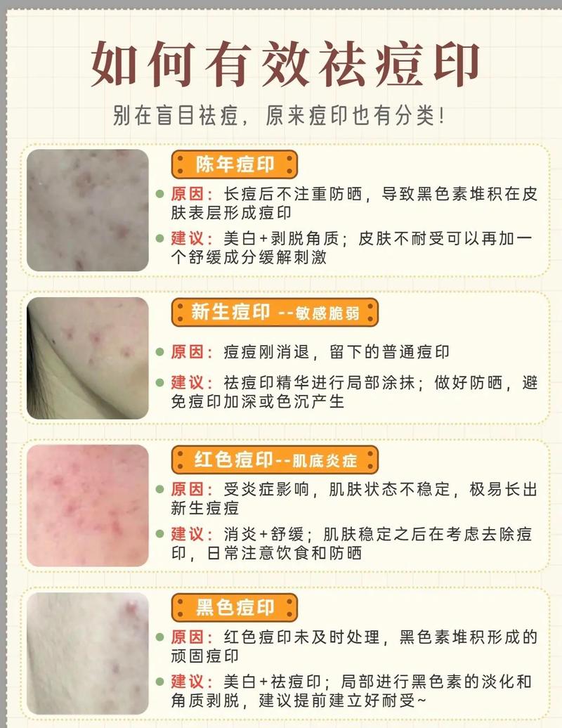 全面解析痘印淡化方法，重拾肌肤光滑与自信