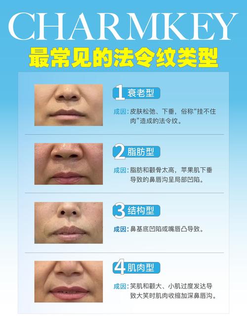 详细阅读:法令纹淡化全攻略:重现青春容颜的有效方法 法令纹淡化全攻略:重现青春容颜的有效方法