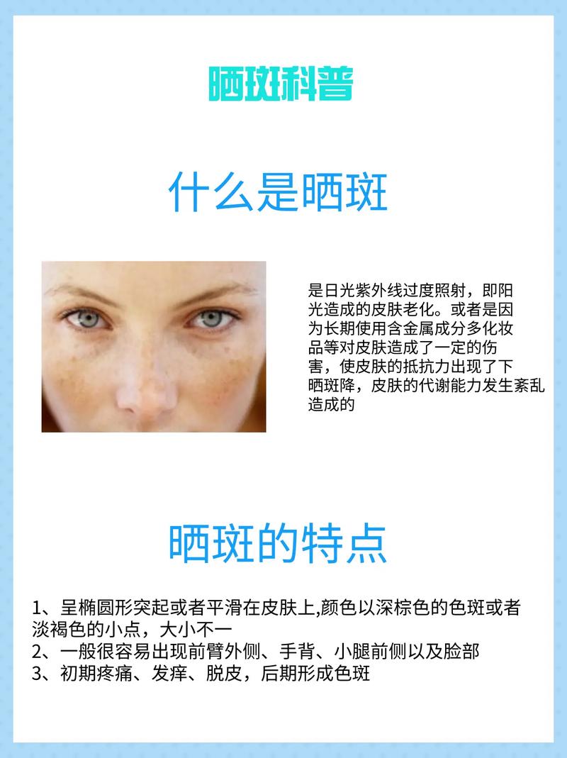 晒斑修复全攻略：科学应对，重焕肌肤光彩