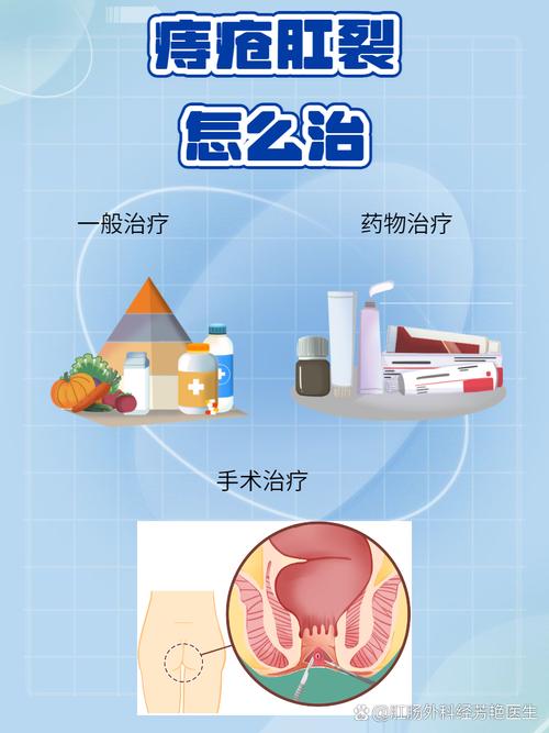 孕期痔疮缓解：守护母婴健康，从“痔”开始