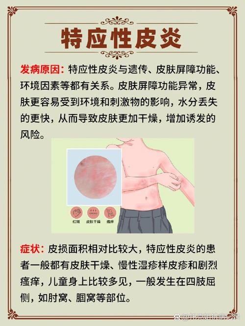 探秘皮炎：成因、类型与全方位应对策略