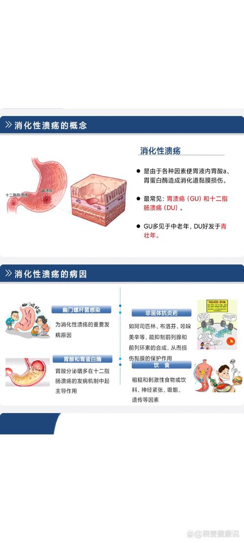 详细阅读:胃溃疡:病因、症状与治疗全解析 胃溃疡:病因、症状与治疗全解析