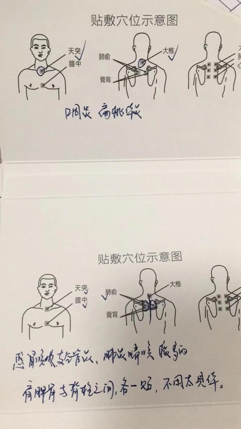 宝宝防咳嗽：守护稚嫩娇音的全方位攻略