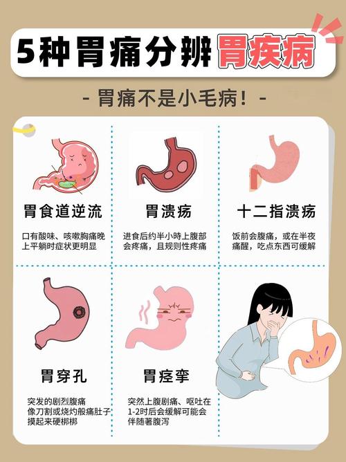 详细阅读:胃痛:不容忽视的身体“警报”与应对之道 胃痛:不容忽视的身体“警报”与应对之道