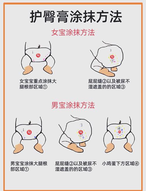详细阅读:守护宝宝娇嫩屁屁,远离红屁屁烦恼——必备护臀膏全解析 守护宝宝娇嫩屁屁,远离红屁屁烦恼——必备护臀膏全解析