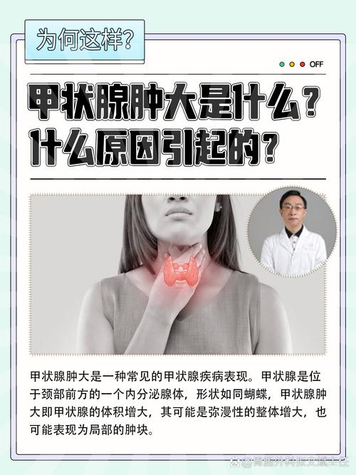 甲状腺疾病,甲状腺疾病的症状有哪些