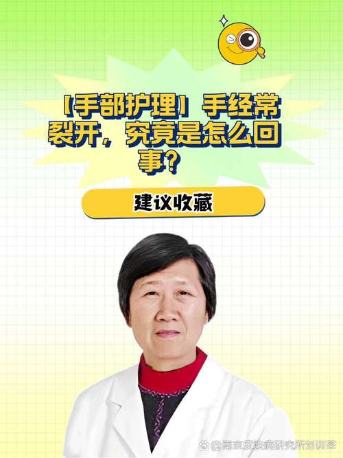 手部干燥粗糙护理,手部干燥粗糙护理措施