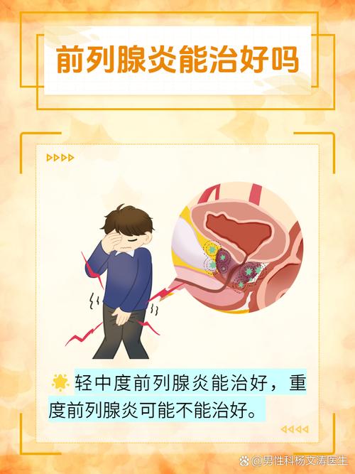 前列腺炎,前列腺炎有哪些症状表现? (男科)
