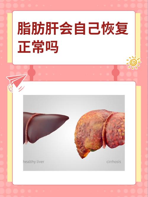 脂肪,脂肪肝是什么原因引起的,该怎么治疗