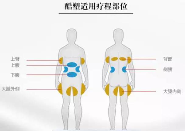 冷冻溶脂技术介绍与效果,冷冻溶脂技术介绍与效果图