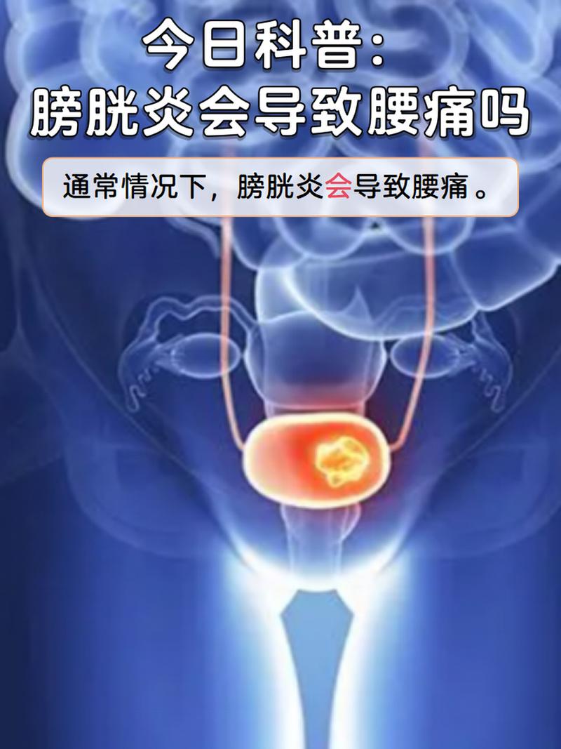 膀胱炎,膀胱炎有哪些症状