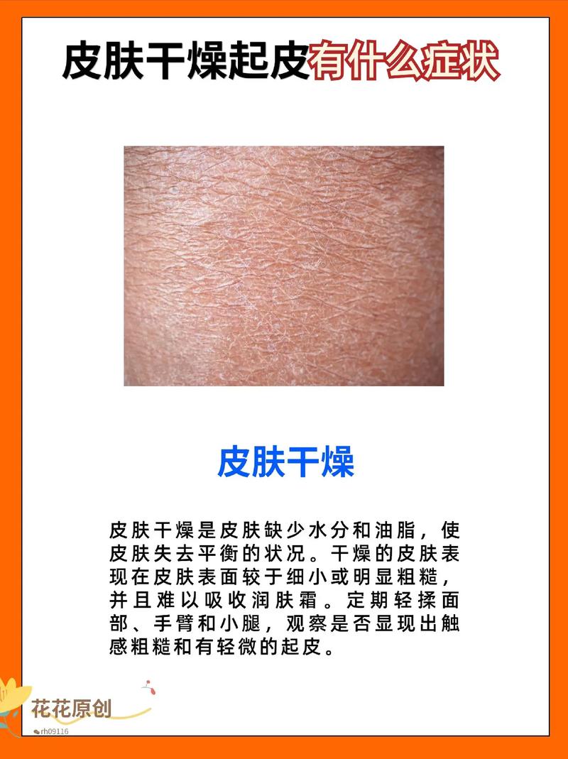 皮肤干燥解决办法,皮肤干燥解决办法有哪些