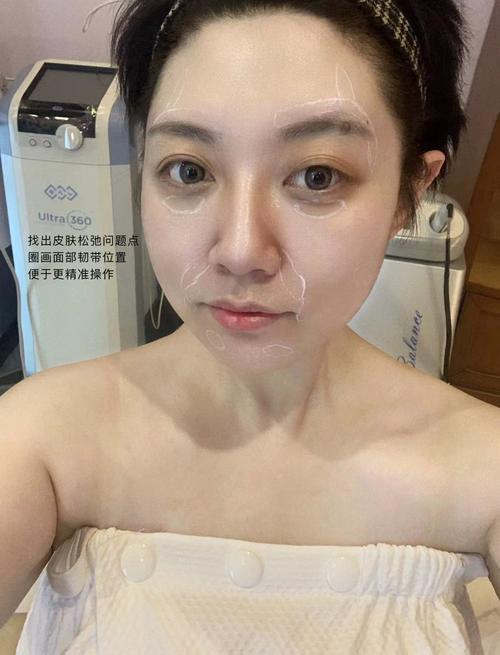 详细阅读:射频紧肤技术原理与应用,射频紧肤技术原理与应用视频 射频紧肤技术原理与应用,射频紧肤技术原理与应用视频
