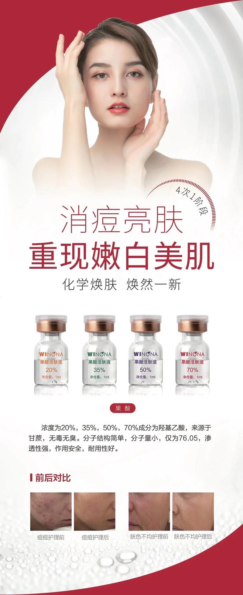 果酸换肤知识与注意事项,果酸换肤知识与注意事项有哪些