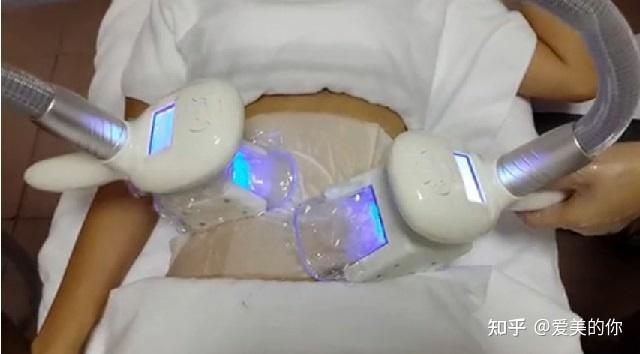 冷冻溶脂减脂效果,冷冻溶脂减脂效果怎么样